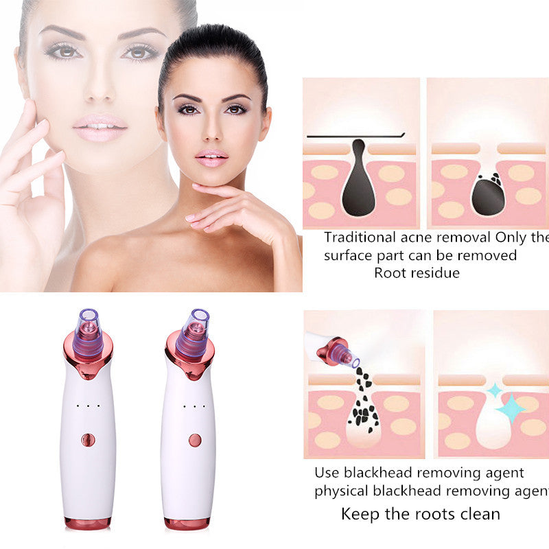 Blackhead remover vacuum suction tool for effective blackhead and pore cleaning. Helps clear skin and reduce acne with gentle suction for deep cleansing.